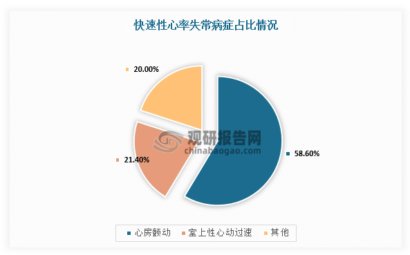 心律失常指心律起源部位、心搏频率与节律以及冲动传导等任一项异常，是由于窦房结激动异常或激动产生于窦房结以外，激动的传导缓慢、阻滞或经异常通道传导导致心脏搏动的频率和（或）节律异常。心律失常的主要分类标准包括失常时心率（快速性、缓慢性）与起源位置（室上性、室性）。快速性指心率大于100次/分，而缓慢性指心率小于60次/分。在快速性心率失常中，较常见的类型包括心房颤动和室上性心动过速等。其中，心房颤动和室上性心动过速分别占快速性心率失常病症的58.6%和21.4%。