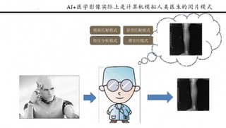 AI在医学影像主要应用图像识别与深度学习两部分    未来可能成为众多医疗细分领域率先爆发领域