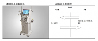 我国血液透析机工作主要过程、发展现状与供求状况及市场份额分析