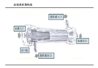 血液透析器构造与国内透析器需求量、批文情况、市场规模及份额