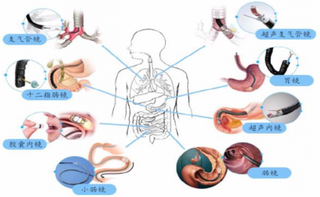 2019年中国内镜诊疗市场规模达31亿元，渗透率提升将推动市场持续增长