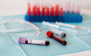 2022年血制品行业卫光生物公司人白批次下降43% 静丙下降24%